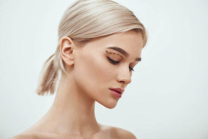 Foto de BLEFAROPLASTIA SUPERIOR E INFERIOR / CIRURGIA DAS PÁLPEBRAS