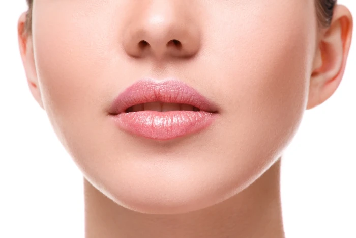 Foto de LIP LIFT / ELEVAÇÃO DO LÁBIO SUPERIOR