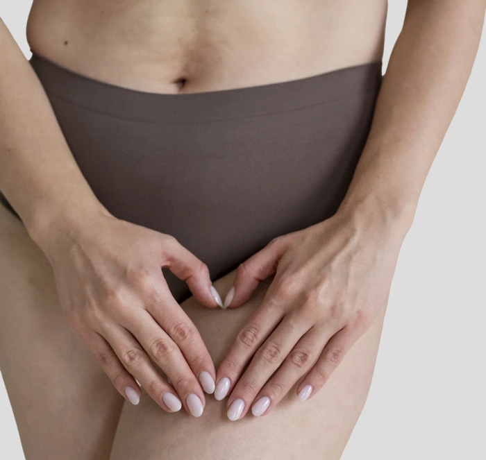 Foto de NINFOPLASTIA